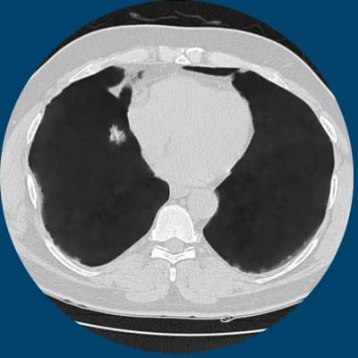 RIVERAIN TECHNOLOGIES, LLC